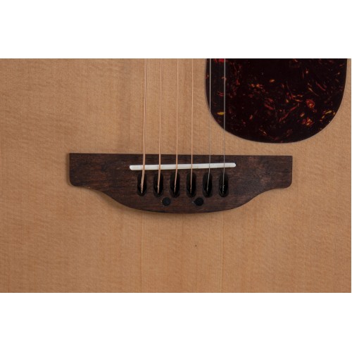 Ovation Applause AAD-96-4 Akustik Gitar